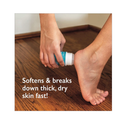 Callus Relief Stick with Powerful 30% Urea - Quick & Easy No-Mess Stick Helps Soften & Smooth Hard Thick Dry Cracked Rough Itchy Skin on Feet Legs Knees Elbows