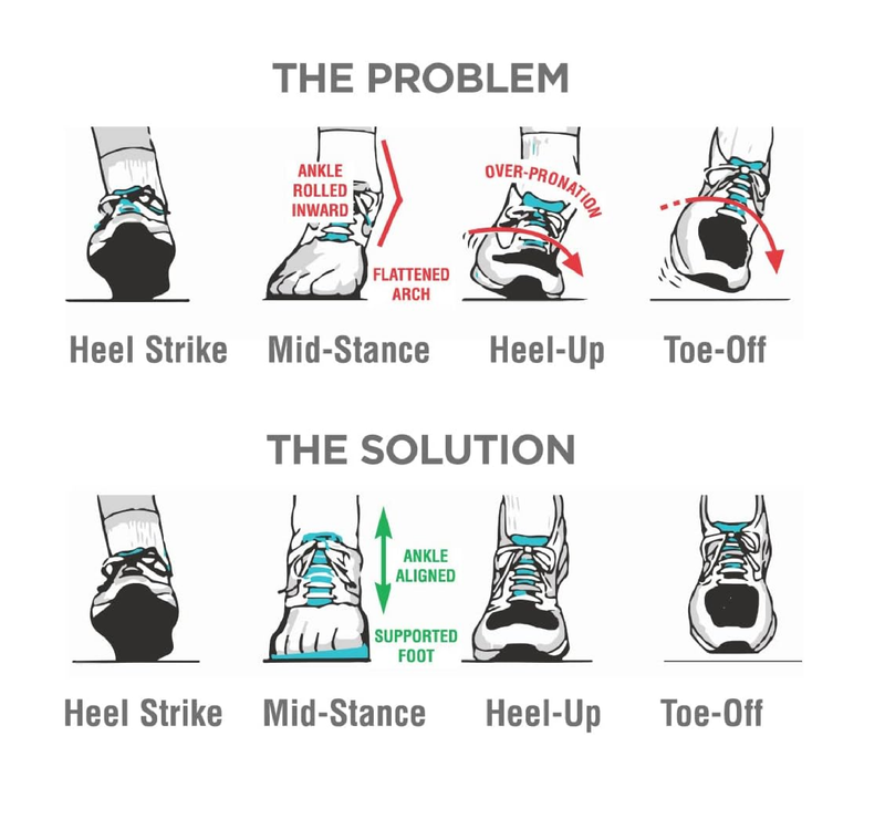 10 Seconds - Flat Foot Orthopedic Insole – Corrective Arch Support for Flat Feet,