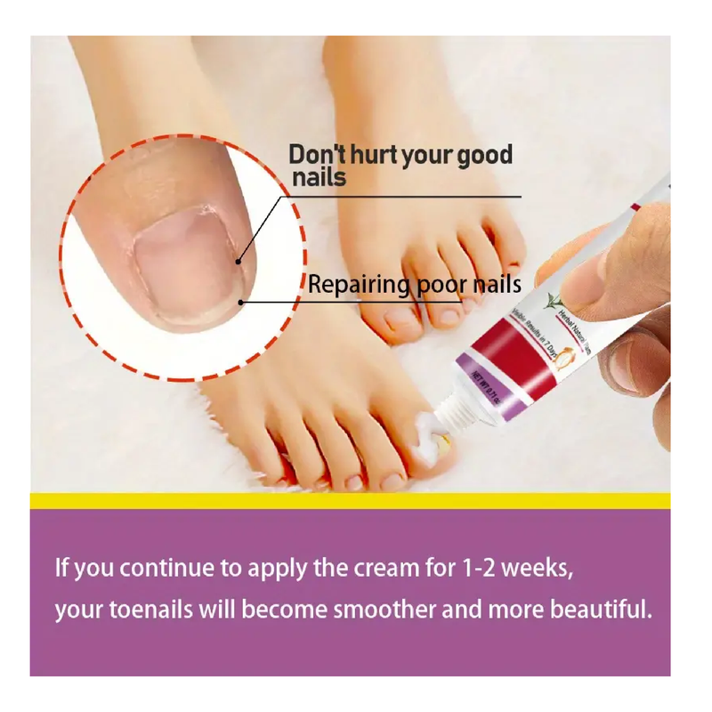 1/2pcs Nail/Toenail Cream For Nail Renewal,Say Goodbye To Ugly Nails,Keep Nails In Good Conditon,Changes Appearance Of Nails