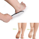BEZOX Professional Foot File Callus Remover, Double Sided Pedicure Rasp for Cracked Heel and Dead Foot Skin - Heavy Duty Surgical Grade Stainless Steel - W/Cloth Storage Bag & Gift Box - Silver — 4