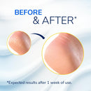 Dr. Scholl's Severe Cracked Heel Repair Restoring Balm 2.5oz, with 25% Urea for Dry, Cracked Feet, Heals and Moisturizes for Healthy Feet — 3