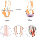 PCSsole 3/4 Orthotics Shoe Insert for Plantar Fasciitis Relief | High Arch-purple — 5