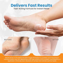 Revitaderm 4D 40% Urea Advanced Foot Cream for Cracked Heels & Dry Skin, Intensive Repair for Rough, Callused Feet, Fast Absorbing, Fragrance Free, Made in USA, 4 oz with Pumice & Brush, 1 Pack — 4