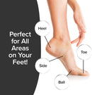 PedEgg Foot File, Painless Callus Remover, Mess-Free, As Seen on TV — 6