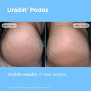 ISDIN Uradin Podos Foot Cream, 10% Urea, Repairs Cracked Feet, 2.5 fl oz — 5