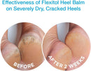 Flexitol Heel Balm 4 Oz Tube (Pack of 2), Rich Moisturizing & Exfoliating Foot Cream. Fast Relief of Rough, Dry & Cracked Skin on Heels/Feet. For Daily Use and Pedicures. Diabetic Safe and Effective — 3