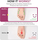 Welnove Metatarsal Pads for Women Men - 4 Pairs Leather Ball-of-Foot Cushions for Forefoot Support - Soft Ball of Foot Pads for Pain Relief, Metatarsalgia, Morton's Neuroma (4 Sizes, S-M-L-XL) 3