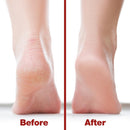 Probelle Double Sided Multidirectional Nickel Foot File Callus Remover - Immediately Reduces calluses and Corns to Powder for Instant Results, Safe Tool (Red) — 4
