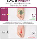 Welnove Metatarsal Pads for Women Men - Drip-Shape - Leather Ball-of-Foot Cushions for Forefoot Support - Soft Ball of Foot Pads for Metatarsalgia, Morton’s Neuroma, Fit for High Heels,Shoes(Size：S) 3
