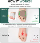 Welnove Metatarsal Pads with Bunion Relief - Upgraded Plush Lining - Ball of Foot Cushions for Metatarsalgia, Sesamoiditis, Morton's Neuroma - Forefoot Protection Sleeve with for Women Men (Size S) 3