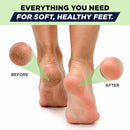 Antifungal Cream for Athletes Foot, Jock Itch, Ringworm, Dry Cracked Heel - Foot Balm — 8