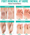 Foot Soak with Epsom Salt 12 Pack Pedicure Spa for Dry Feet — 4