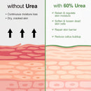 Urea Cream 60 Percent For Feet Maximum Strength Plus Salicylic Acid 2%, Tea Tree Foot Lotion For Dry Feet, Foot Cream Intensive Repair Foot Moisturizer 5.29oz — 6