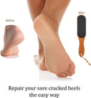 Pumice Stone Foot File - Wooden Pedicure Feet Scrubber with Handle for Callus, Dry, and Dead Skin Removal - Heel Scraper for Feet, Hands, and Body - Foot Filer for Use in Shower - Brown — 5