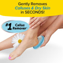 PedEgg Foot File, Painless Callus Remover, Mess-Free, As Seen on TV — 1