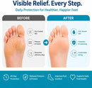 Metatarsal Pads for Women & Men, Ball of Foot Cushions Pain Relief, Morton's Neuroma & Metatarsalgia Support, Foot Pads Inserts, 2 Pairs 3