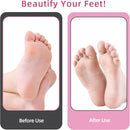 APRELM Electric Foot Callus Remover with 80pcs Sandpaper Discs, 4.8IN Longer Professional Callus Remover for Feet, Pedicure Tools Foot File for Dead Skin - Rose Pink — 6