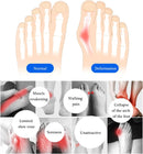 SooGree 2 Pairs Honeycomb Fabric Forefoot Pads Men Women Soft Metatarsal Foot Pads Soft Gel Ball of Foot Cushions for Pain Relief 5