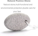 Natural Foot Pumice Stone for Feet, Borogo 2-Pack Lava Pedicure Tools Hard Skin Callus Remover for Feet and Hands - White — 8