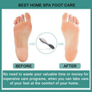 CAREHOOD Foot File Callus Remover - Foot Scrubber Pedicure Tool (Grey) — 6