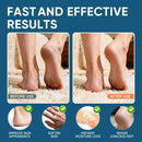 Urea Cream 60% with 2% Salicylic Acid, Urea Cream 60 Percent for Feet Maximum Strength, Foot Cream & Callus Remover for Dry Cracked Heels, Rough Thick Skin, Deep Hydration, 5.29 oz — 3