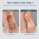 Upgraded Electric Foot Callues Remover, Portable Electric Foot Files with 3 Heads, Rechargeable Feet File for Foot Care, Waterproof Deadskin Remover, Pedicure Tool for Dry and Crack Feet — 8