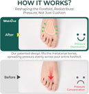 Welnove Metatarsal Pads for Women Men - T-Shape - 4 Pairs Leather Ball-of-Foot Honeycomb Cushions - Soft Ball of Foot Pads for Metatarsalgia, Morton’s Neuroma, Fit for High Heels, Shoes - Gray 3