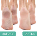 Salon Foot Pumice and Scrubber for Feet and Heels Callus and Dead Skins, Safely and Easily Eliminate Callus and Rough Heels (Pack of 1) — 3