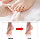 7 Pcs Professional Pedicure Tools for Feet, Stainless Steel Ingrown Toenail Removal Blade Kit with File, Toe Nail Knife Set for Men Women,Corn and Rasp Callus Remover Foot Scraper for Dead Skin — 7