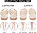 Dr. Foot's Supination Insoles & Overpronation Insoles, Medial & Lateral Heel Cups for Foot Alignment, Knee Pain, Bow Legs, Osteoarthritis - Clear - Medium - Women's 8-11.5|Men's 6-10.5 — 2