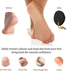 Pumice Stone for Feet - Natural Foot Scrubber for Dead Skin Callus Removal - Black — 3