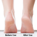 Nano Foot File, Foot Scrubber Callus Remover, Foot Care Pedicure Tool, Foot File with Nano-Level Grinding Points, Portable Foot Scrubber for Dead Skin Removal, Cracking, Wet and Dry Feet — 3