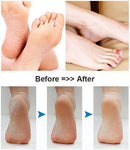 Foot Scrubber Electric Callus Remover Rechargeable Foot File Hard Skin Remover Pedicure Tools Electronic Callus kit for Cracked Heels and Dead Skin with 2 Roller Heads, Blue — 3