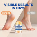 Urea Cream Stick 60% plus Salicylic Acid 2%, Maximum Strength Urea Foot Cream for Dry Cracked Heels, Feet Callus Remover, Hands Knees Exfoliating Dead Skin, Softening Skin Moisturizer Lotion — 4