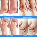 Urea Cream with 2% Salicylic Acid Foot Cream for Dry Cracked Heels, Heel Care Cream 5.29 Oz (Pack of 1) — 7