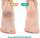 GILDEN TREE Urea Gel 42 Percent For Feet Maximum Strength Softens Cracked Heel Calluses & Thick Toenails — 2