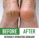 PurOrganica Urea 40% Foot Cream - Made in USA - Callus Remover - Moisturizes & Rehydrates Thick, Cracked, Rough, Dead & Dry Skin - For Feet, Elbows and Hands - With Pumice Stone and Brush — 7