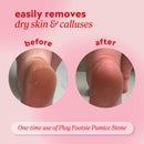 Onyx Professional Double Sided Pumice Stone for Feet, 2 pk - 100% Siliglass — 2