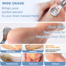 36 Pcs Callus Shaver for Feet Set, (1Stainless Foot File &1 Foot File Heads & 30 Replacement Slices Blades & 4 Pedicure Knife), Professional Callus Remover for Feet Tools for Wet and Dry Feet — 4