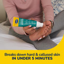 Dr. Scholl's Foot Callus Remover Gel for Feet, Foot File Pedicure Kit — 3