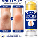 AUK 60% Urea Foot Care Stick with 2% Salicylic Acid, Moisturizing Foot Balm for Dry Cracked Heels, Rough Thickened Skin & Callused Feet, Targeted Stick for Feet Care, 1.41 oz — 3