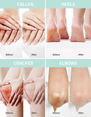Grocerism Urea Cream 40% for Feet Maximum Strength Hand & Foot Cream 5.29oz — 6