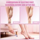 Pedicure Tool, Foot Callus Remover, Electric Pedicure Set, Foot Care, Removes Rough Dead Skin on The Feet, Making Your Feet Smooth. (Pink) — 5