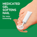 Dr. Scholl's Ingrown Toenail Pain Reliever, Medicated Gel Softens Nails for Easy Trimming, Foam Ring and Bandage Protect the Affected Area, Ingrown Toenail Treatment, White 0.3 Oz — 6