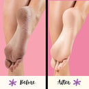 Mr. Pumice Purple PUMI Bar - Coarse Pumice Stone for Feet Callus Remover Pedicure Tools for Feet Foot Scrubber Skin Exfoliator Block, 4 Pack — 3
