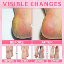 Urea Cream 60% Plus Salicylic Acid 2% Intensive Foot Repair Balm Stick for Dry Cracked/Chapped Heel/Hands Intensively Moisturization, Callus Removal/Softening/Soothing-Peach Scent|1.41 Oz/40 G — 3