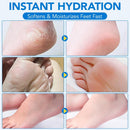 Uruses Urea Cream 60% plus Salicylic Acid 2% Urea Foot Care Stick, Foot Cream for Foot Callus Remover, Feet Moisturizer Stick for Dry Cracked Heels, Hands, Knees, Hydrating Heel Balm, Easy To Use — 7