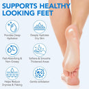Uruses Urea Cream 60% plus Salicylic Acid 2% Urea Foot Care Stick, Foot Cream for Foot Callus Remover, Feet Moisturizer Stick for Dry Cracked Heels, Hands, Knees, Hydrating Heel Balm, Easy To Use — 4