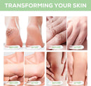 Urea Cream 40%, 4.23 oz, Softening of Cracked Heels — 5