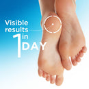 Flexitol Heel Balm, Cracked Heel Cream & Foot Balm, Intensive Hydration for Dry, Rough Feet & Heels, Urea-Based Moisturizing Cream, 4 oz Tube — 3